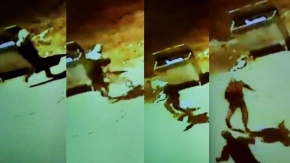Denizli'de çocuğun bacağını ısıran pitbull kamerada